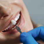 El aumento de tratamientos con implantes dentales en Madrid refleja un cambio positivo en la salud bucodental integral