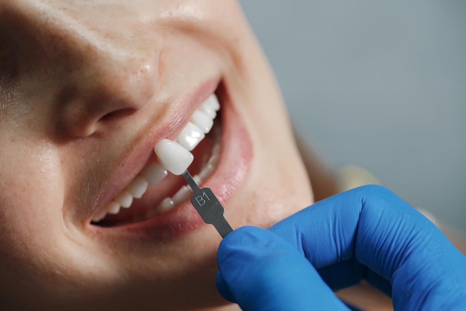 El aumento de tratamientos con implantes dentales en Madrid refleja un cambio positivo en la salud bucodental integral